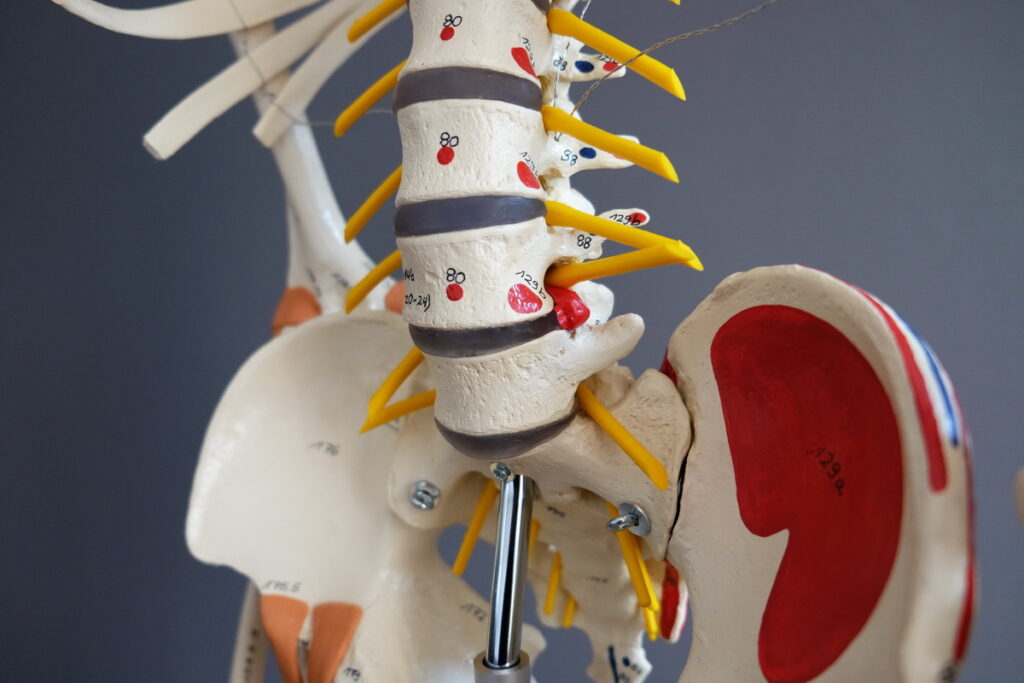 Anatomie Bandscheibenvorfall Merkle Dubois Praxis fuer Chinesische Medizin
