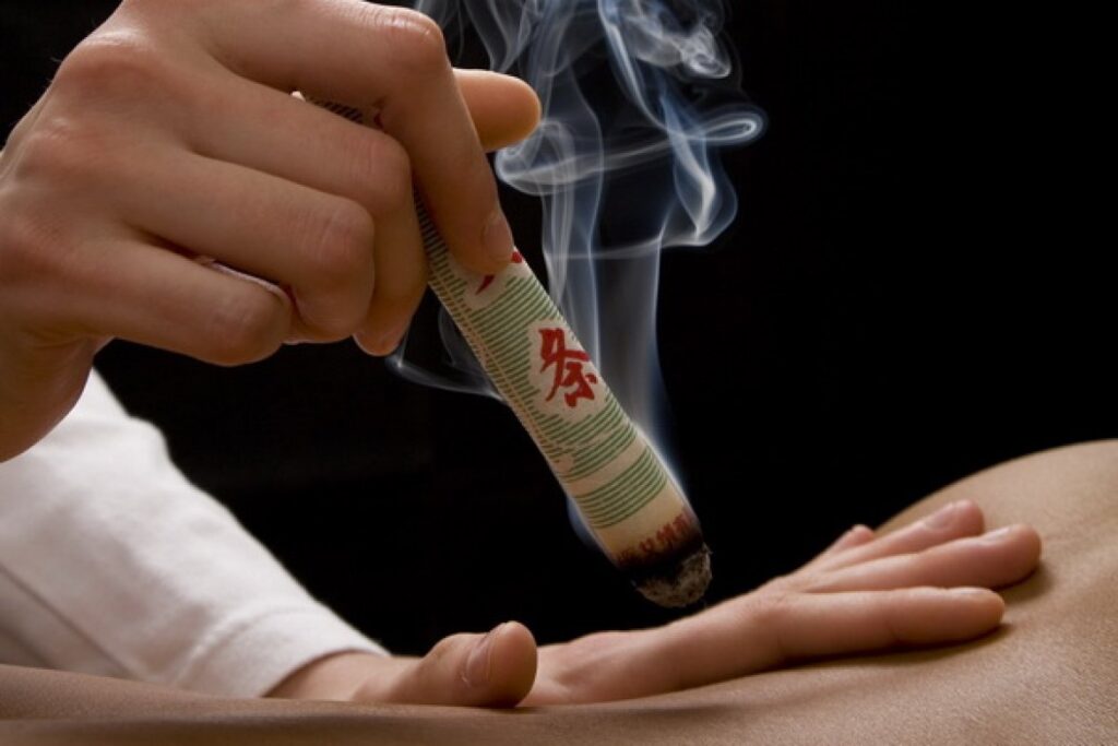 Stabmoxa am Rücken | Moxibustion | Merkle Dubois TCM Praxis Basel